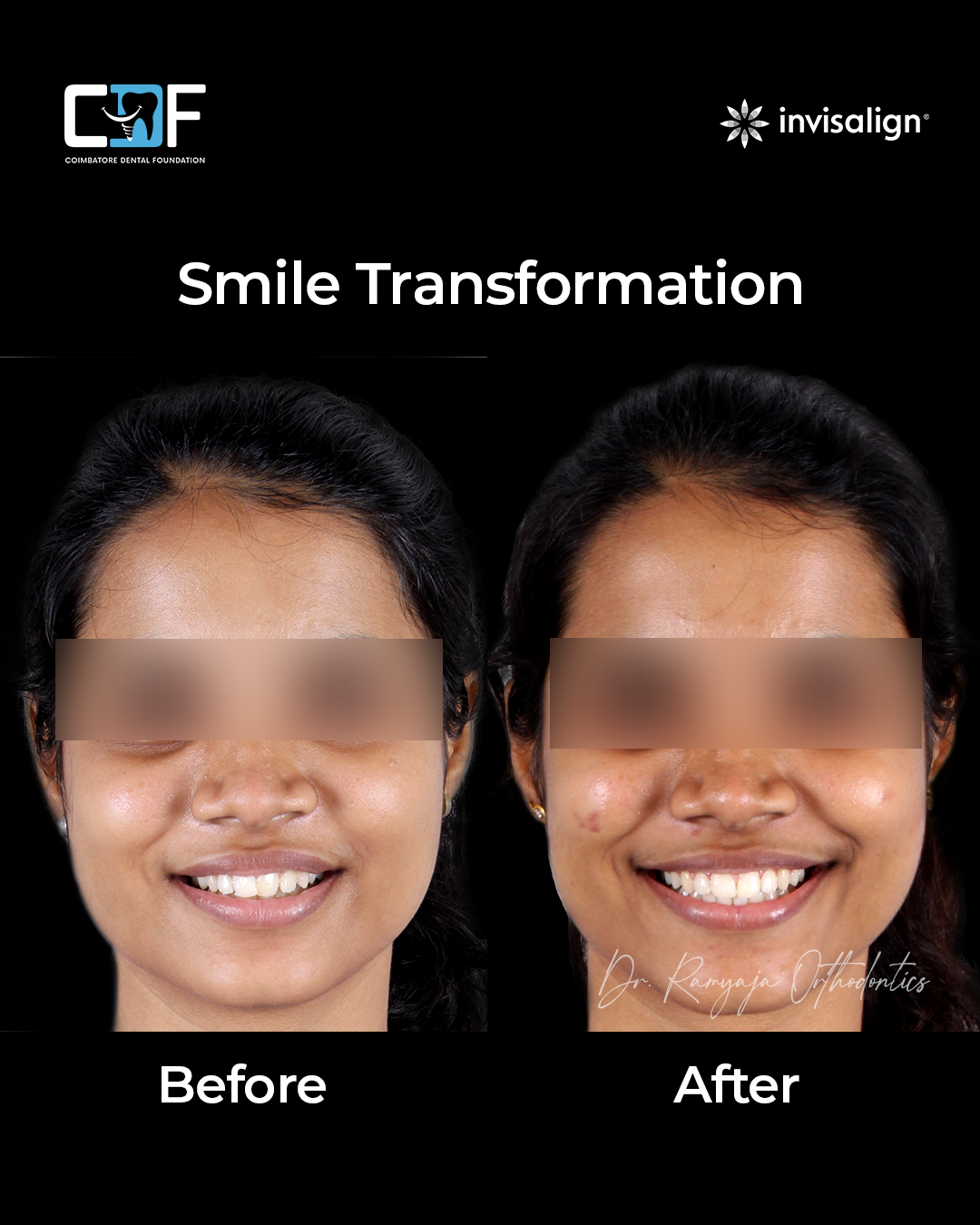 Before After Result
